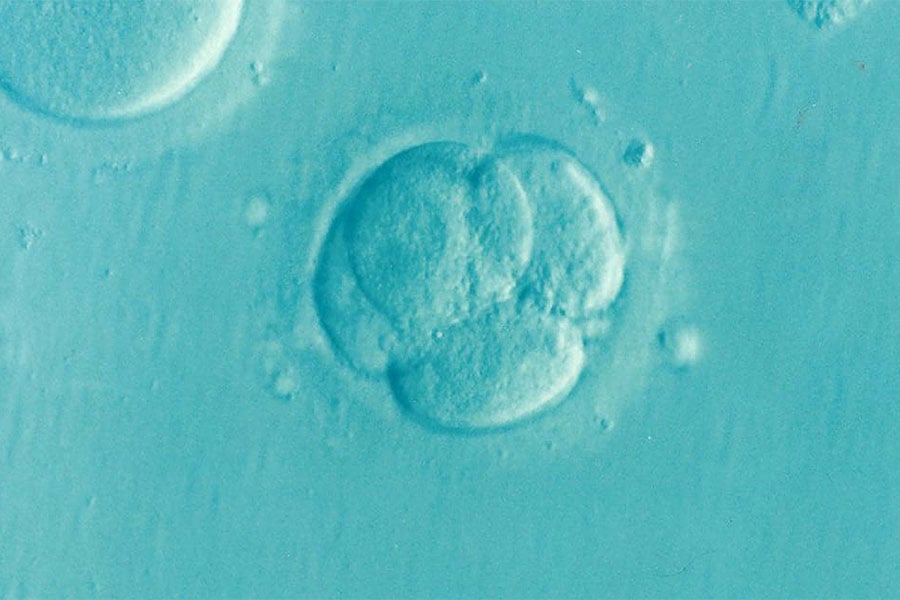 microscopic view of IVF baby