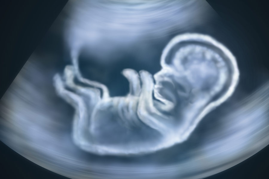 Ultrasound illustration of baby in mother's womb. (Shutterstock/Alex Mit)