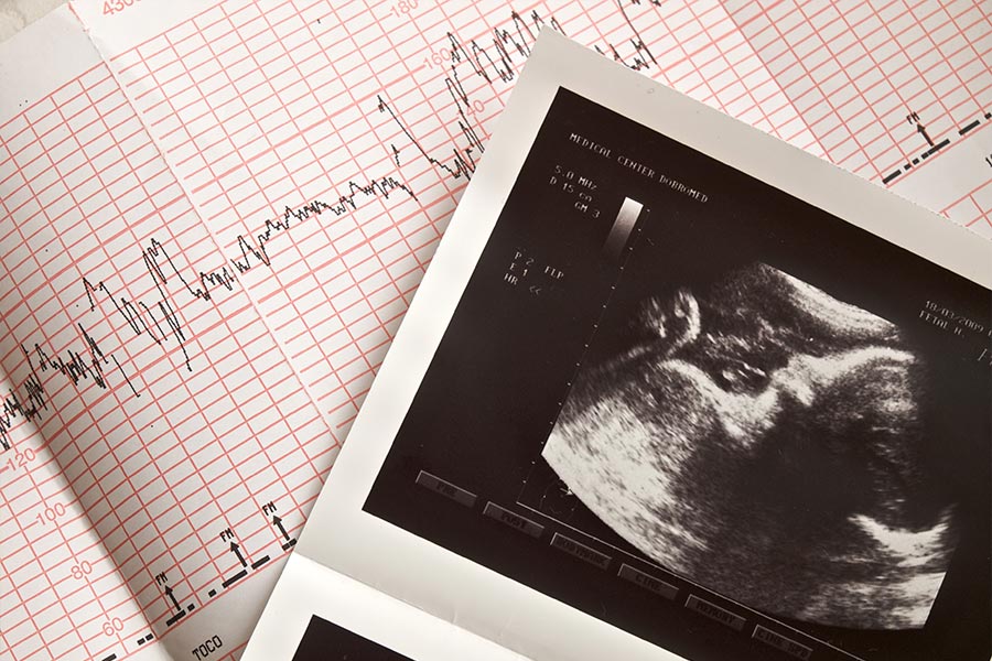Ultrasound portrait of unborn baby and cardiogram results